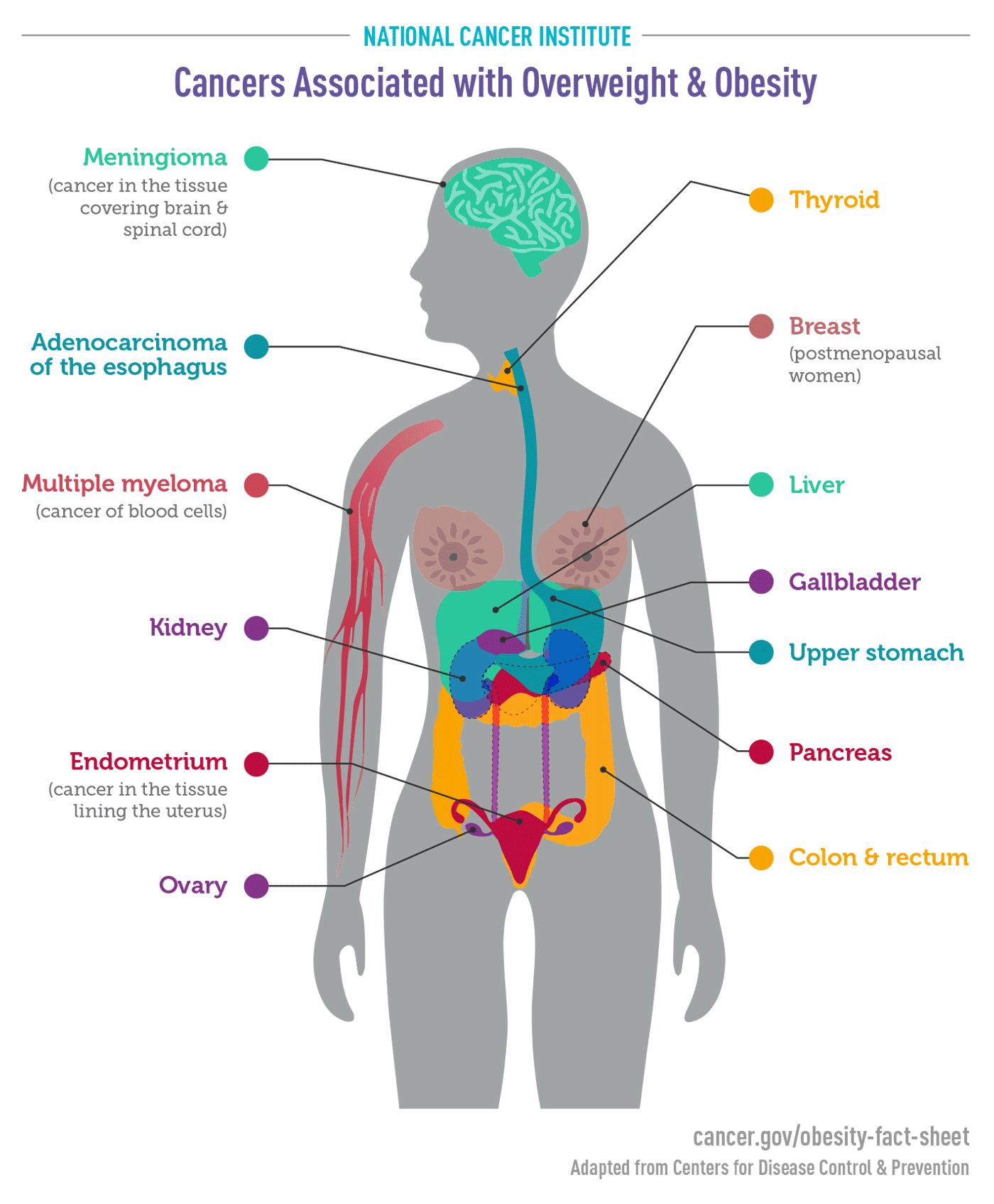 Obesity & Cancer Inforgraphic